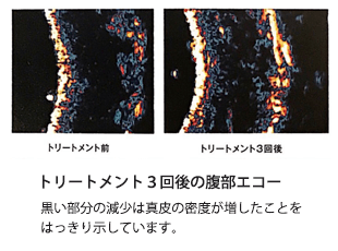 アライアンスSPA